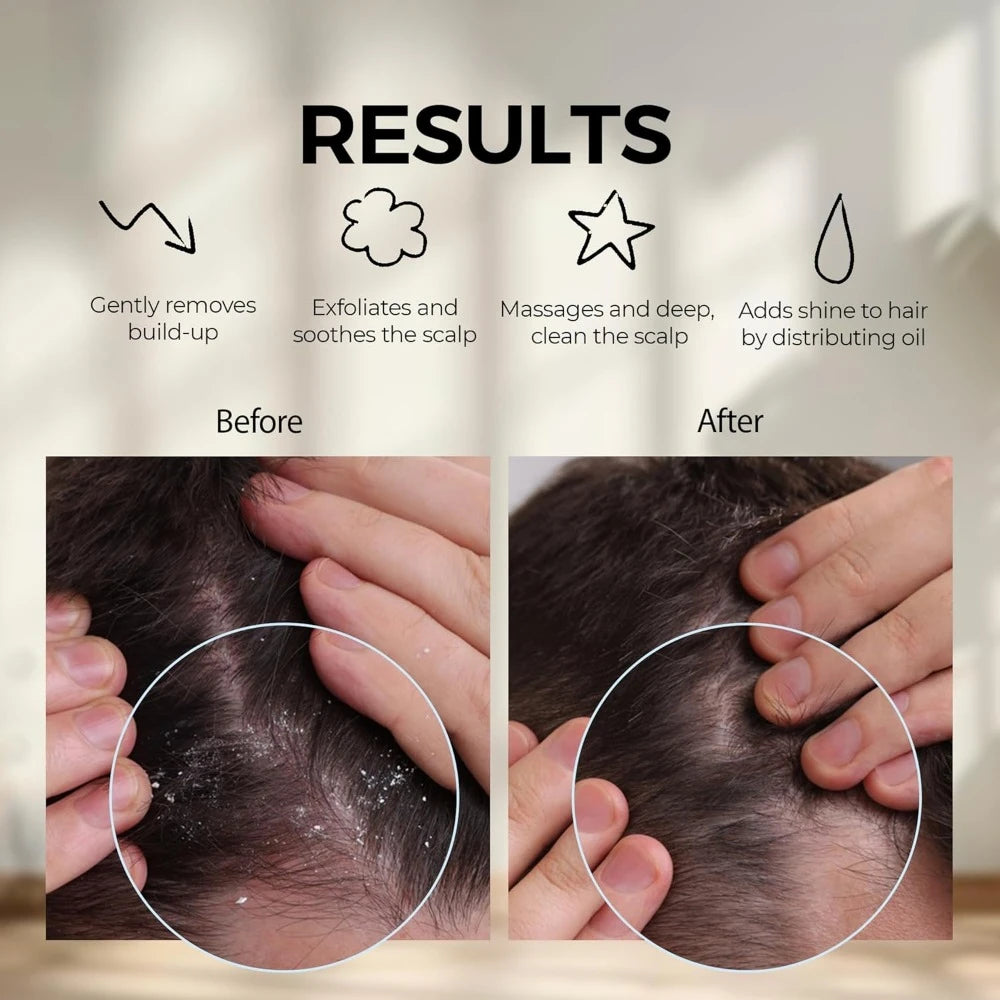 Scalp Massage Silicone Scalp Scrubber and Exfoliator